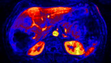 Abdominal imaging