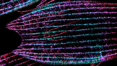 Actin in a developing butterfly scale