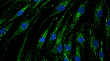 close up image of mitochondria in fibroblasts