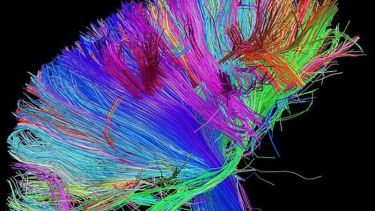 White matter pathways of the human brain revealed by diffusion tensor imaging