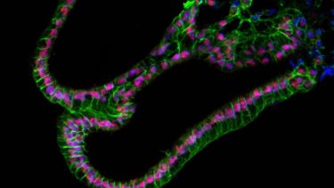 Sensory stem cell biology and regeneration hero image