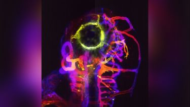 Using transgenic zebrafish lines visualizing the endothelial cell membrane it was possible to study kugeln. In this image the head vasculature of a 3 day old zebrafish shown (depth-coded)