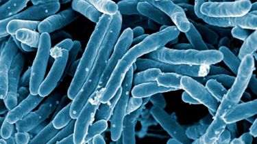 Mycobacterium tuberculosis bacteria. Credit: NAID
