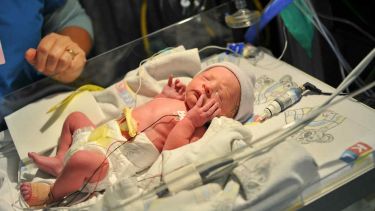 A premature baby receiving care in an incubator.