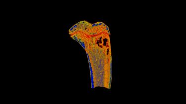 An image of a bone