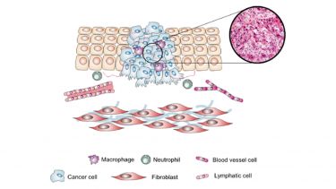 Schematic illustrating the major components of the tumour microenvironment of a squamous cell carcinoma