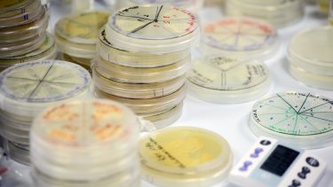 A collection of petri dishes - image