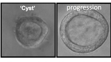 Cyst progression in vitro
