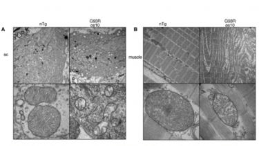 Pathological changes observed in G93R os10 spinal cord and muscle