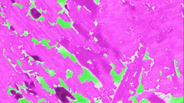 Microstructure of an alloy based on titanium, vanadium, chromium, zirconium and silicon