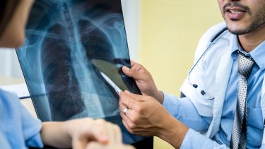 A doctor looking at a lung scan.