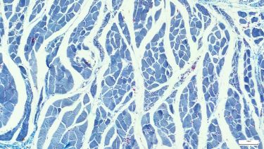 Microscopic photo of a professionally prepared slide demonstrating a Cardiac muscle section
