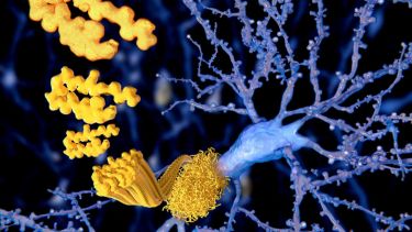 A close up amyloid beta peptide, involved in alzheimers