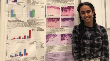 Female Dental student stands in front of poster at competition