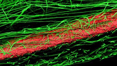 Image take of scaffolds used in the human body to aid tissue regrowth