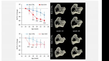 Percentage change, from 14 weeks baseline, in trabecular bone volume fraction