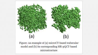 Comparison of HR-pQCT- and microCT-based finite element models