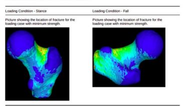 Computer Tomography to Strength Report showing results of Finite Element Analysis of a patient's Femur