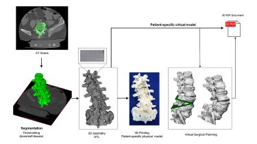 Definition of virtual 3D geometry from a CT scan.