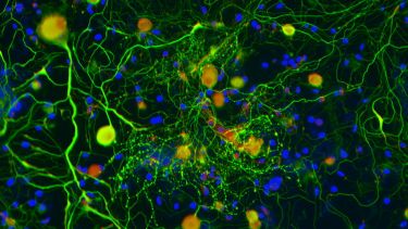 Highlighted Neurons