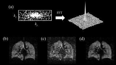Compressed sensing simulation for lung MRI