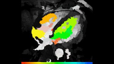 Stylised image of cardiac 4D flow segmentation