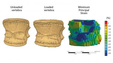 Diagram showing unloaded vertebra, loaded vertebra and minimum principal strain.