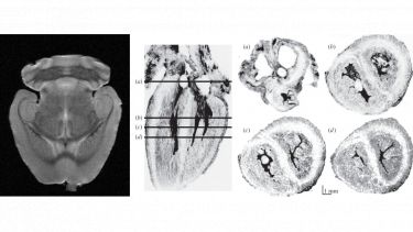 Images of excised mouse brain and foetal heart