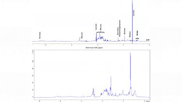 High-resolution NMR spectra of a biofluid and biopsy tissue sample