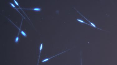A microscopic image of zebrafish sperm