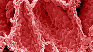 SEM alveoli in the lung, close-up.