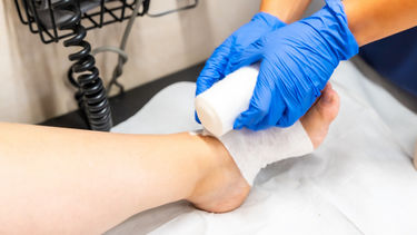 Nurse dressing a chronic foot wound