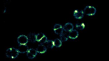 microscopic image of staph aureus labeled by fluorescence