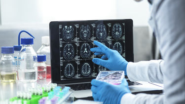 brain scan