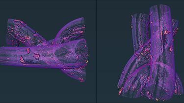 A 3D tomography image of PP mesh