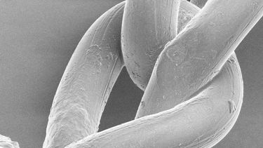 A scanning electron microscope (SEM) image of PP mesh showing surface degradation