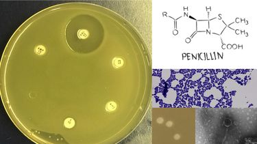 a collage of a petri dish, the atomic symbol for penicillin and other microorganisms