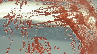 Petri dish