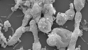Scanning Electron Micrograph of antimicrobial treated biofilms showing cell disruption- seen as cell deformity and blebbing