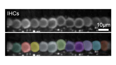 In vivo hair cells