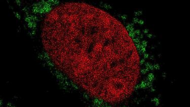 Dual colour STED image of chromatin in the nucleus