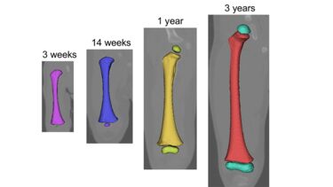 Computer models of paediatric femora in very young children at different ages