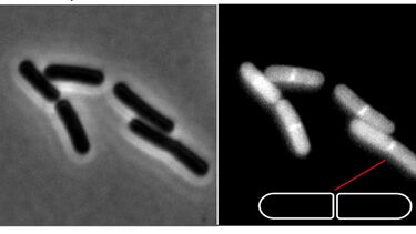 Image of a bacteria under a microscope 