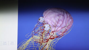 Image of patient anatomy on a virutual reality tablet screen showing blood vessels, eyes and brain