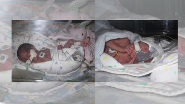 Two newborn babies with breathing tubes in the hospital