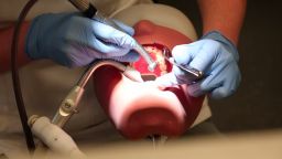 Dentist training: mouth and teeth