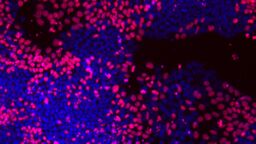 Microscopic image of a culture of STEM cells