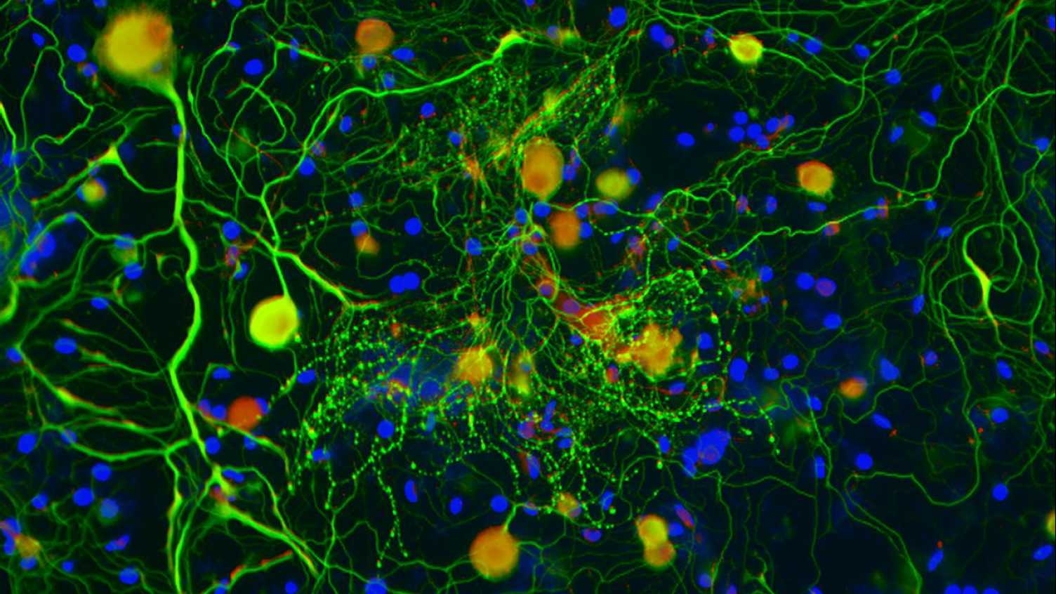 Thumbnail for Novel botulinum compound relieves chronic pain | Biosciences 