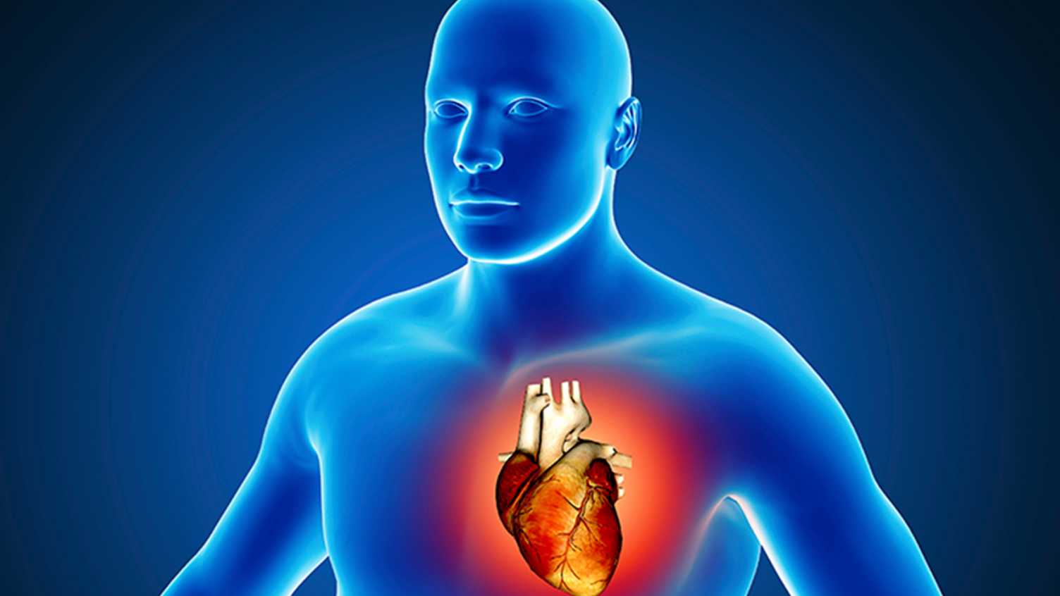 Thumbnail for Cardiovascular disease | Medicine and Population Health 