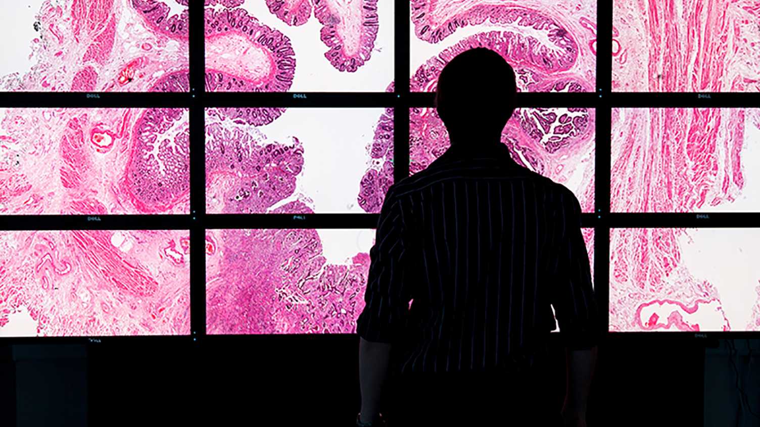 Thumbnail for North receives £10 million government investment for AI and digital pathology |…